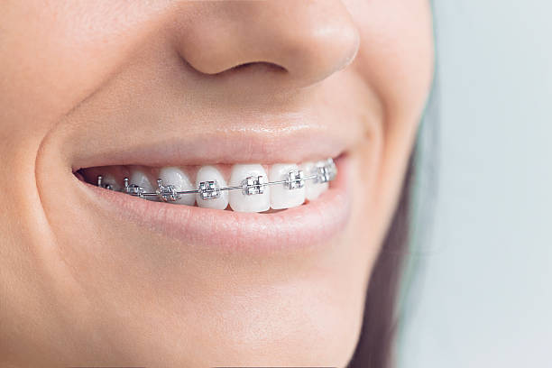 Best Dental Fillings (Composite and Amalgam)  in Rialto, CA